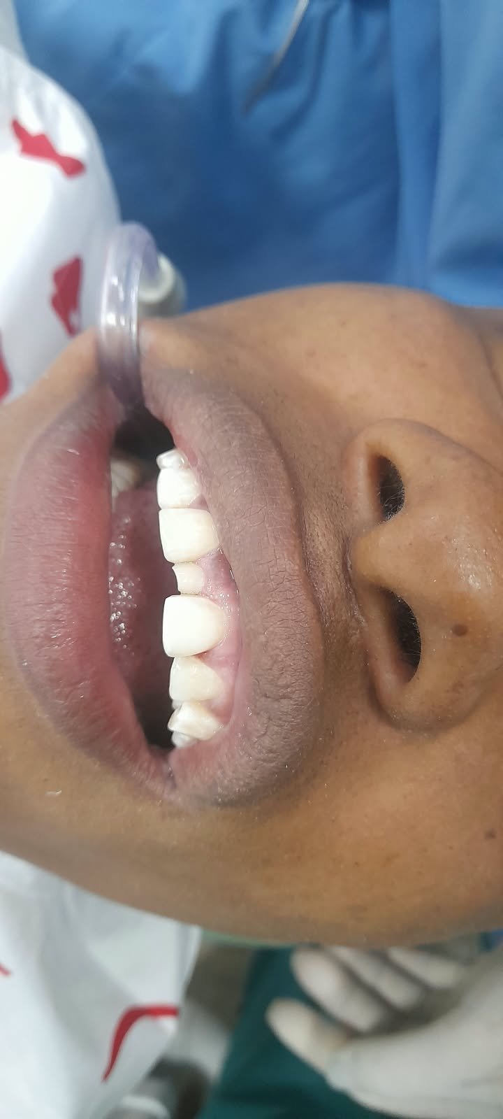 Vista dental inicial del caso clínico 03